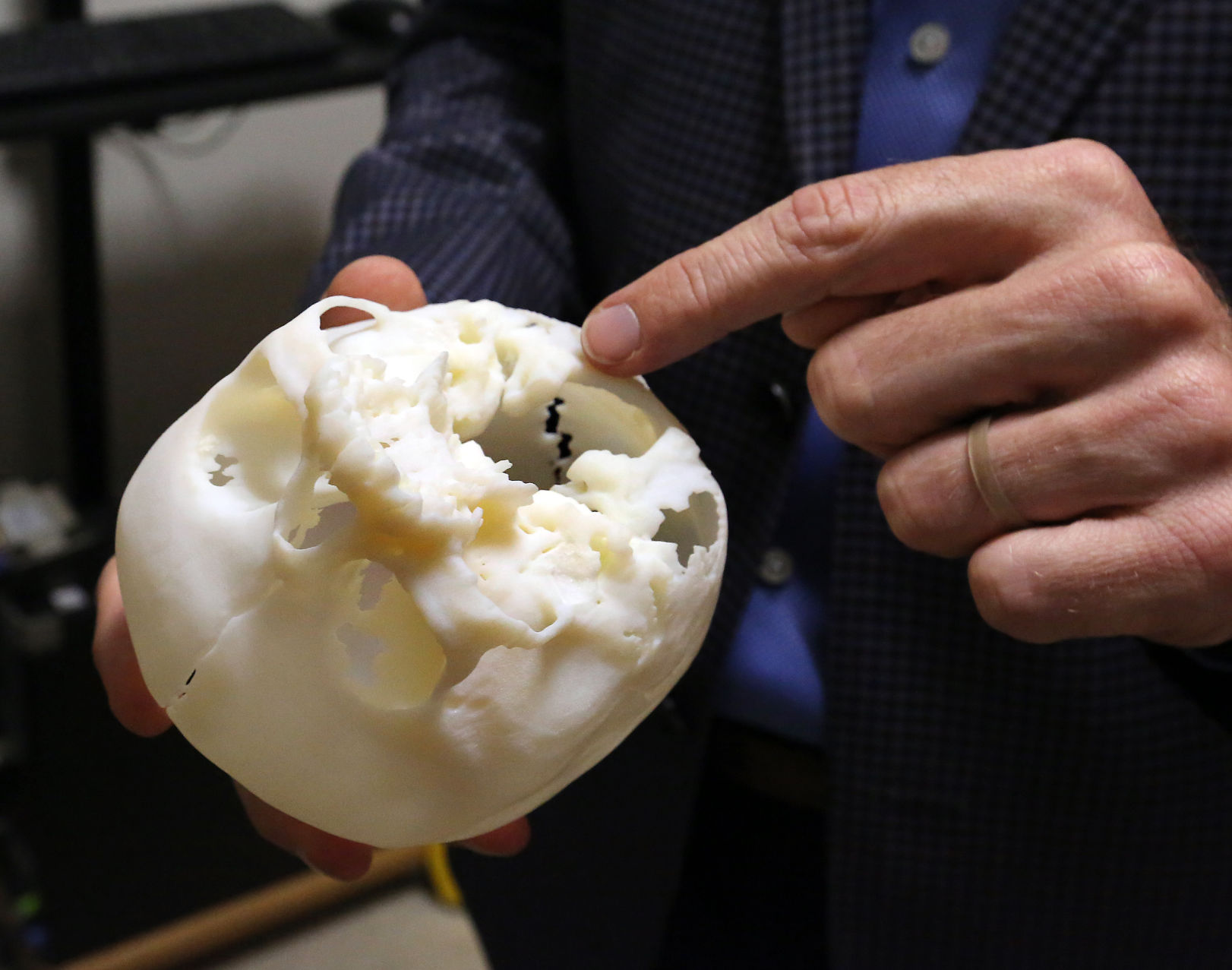 3d Printed Skulls